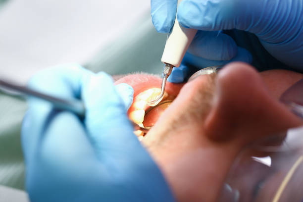 Best Emergency Treatment for Toothache in Somerton, AZ